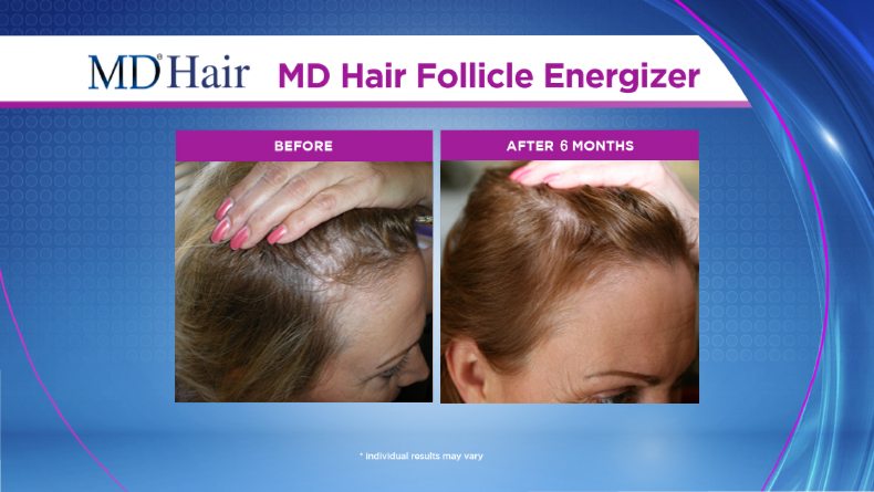 Before and After