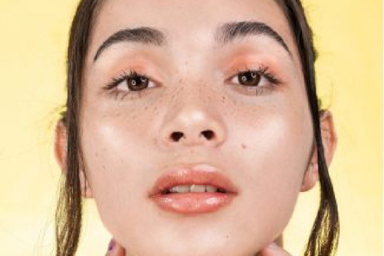 Skin Pigmentation Treatment MD Laser and Cosmetics
