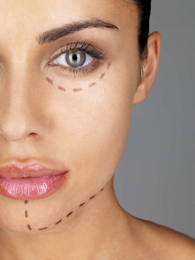 Brown Spots Removal
