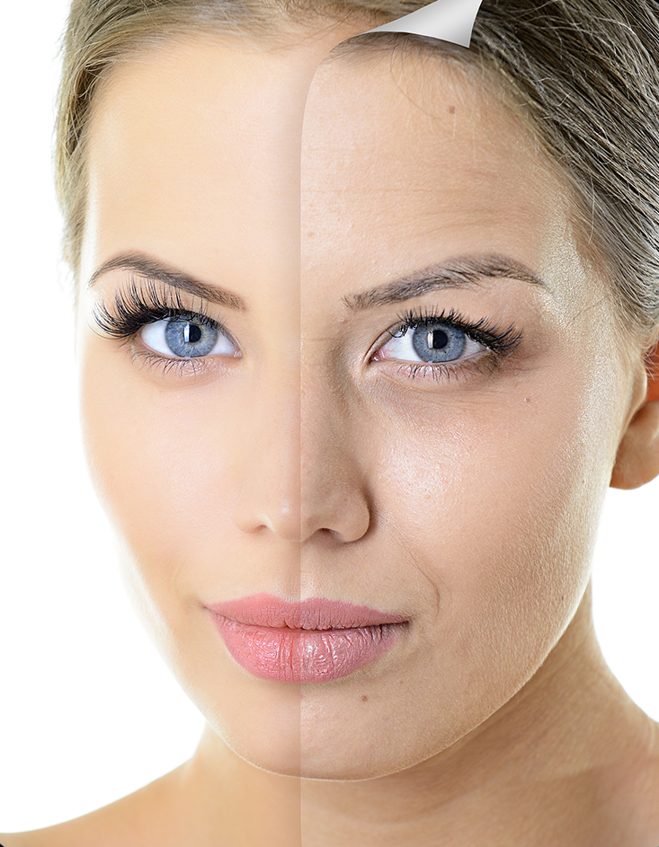 Anti Aging Treatment MD Laser and Cosmetics